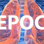 plíce a EPOC efekt